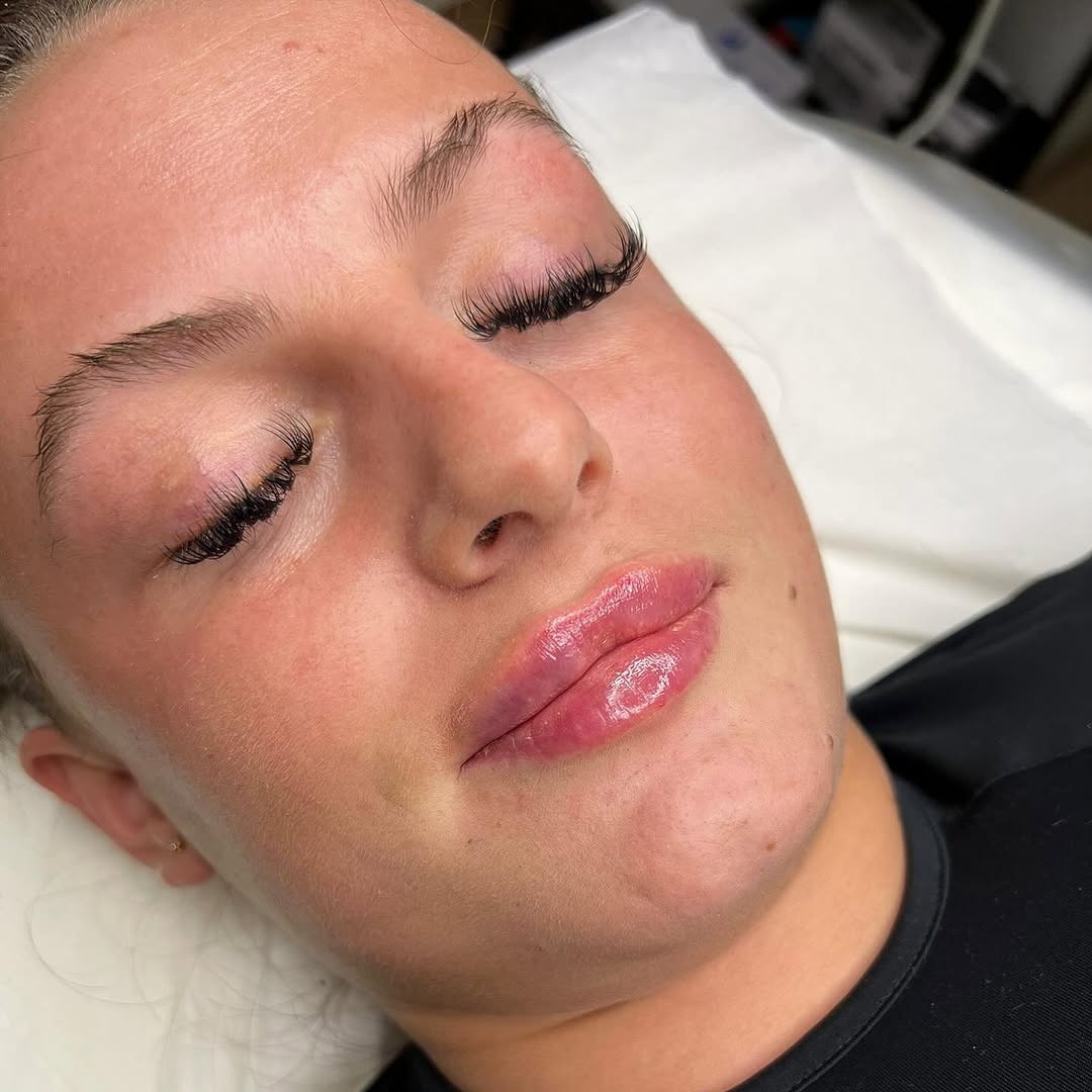 Definition through the lower lip