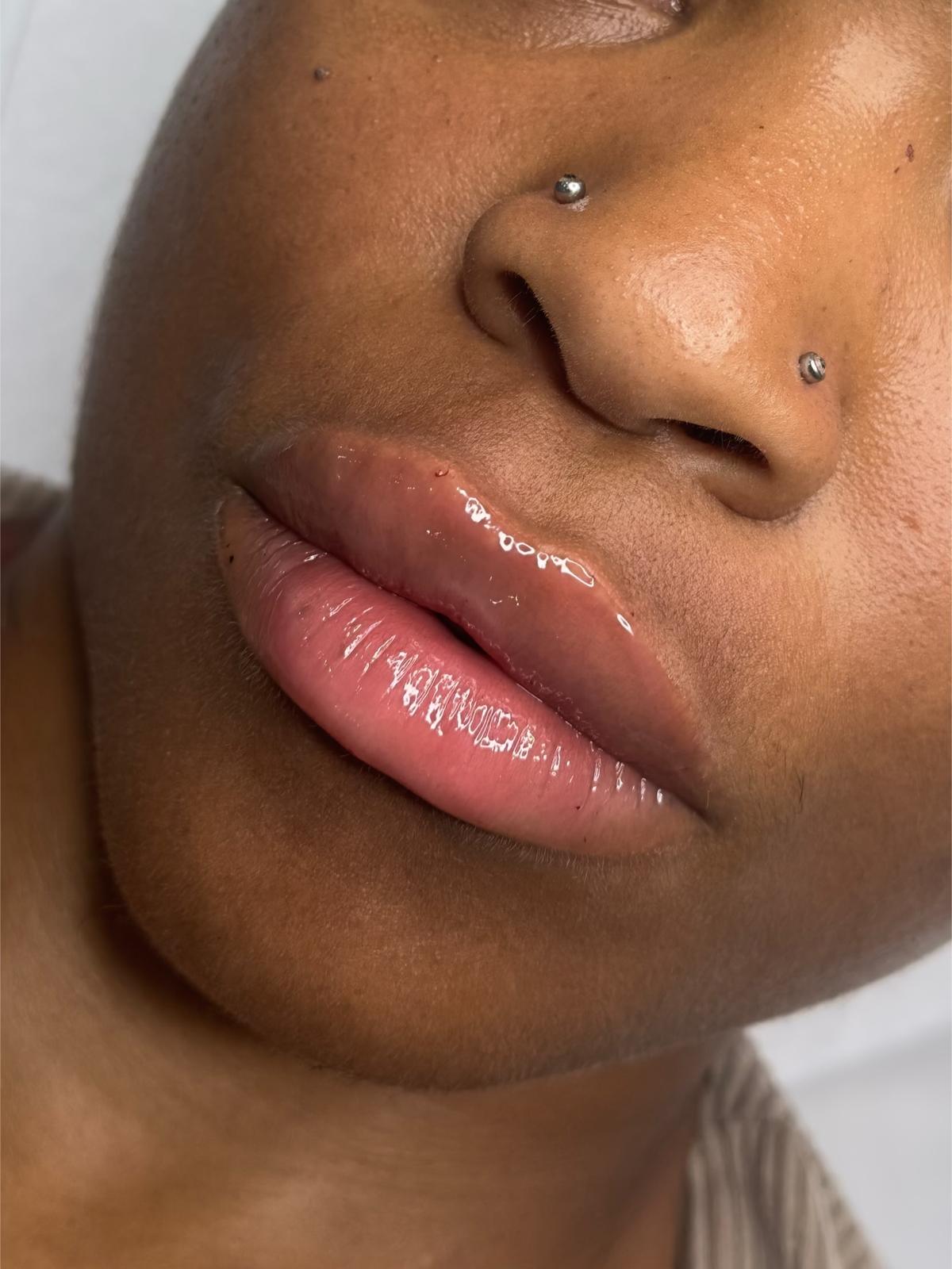 Definition through the body of the lip